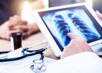 Care este legătura dintre cancer și poluare