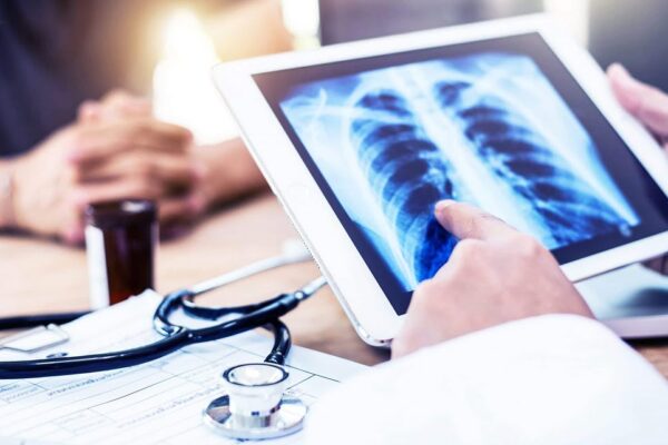 Care este legătura dintre cancer și poluare