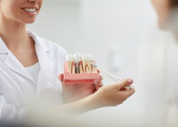 Întrebări de pus atunci când alegi un chirurg oral